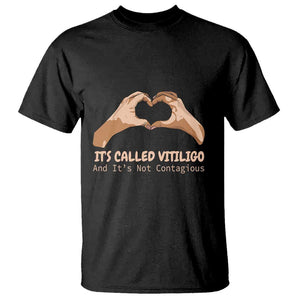 Vitiligo Awareness T Shirt It's Called Vitiligo And It's Not Contagious TS09 Black Print Your Wear