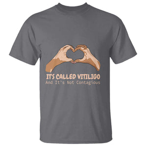 Vitiligo Awareness T Shirt It's Called Vitiligo And It's Not Contagious TS09 Charcoal Print Your Wear