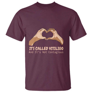 Vitiligo Awareness T Shirt It's Called Vitiligo And It's Not Contagious TS09 Maroon Print Your Wear