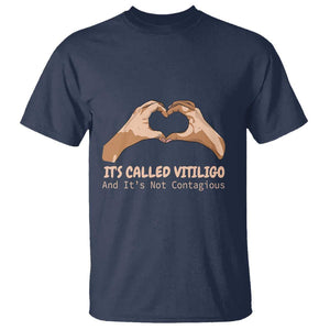 Vitiligo Awareness T Shirt It's Called Vitiligo And It's Not Contagious TS09 Navy Print Your Wear