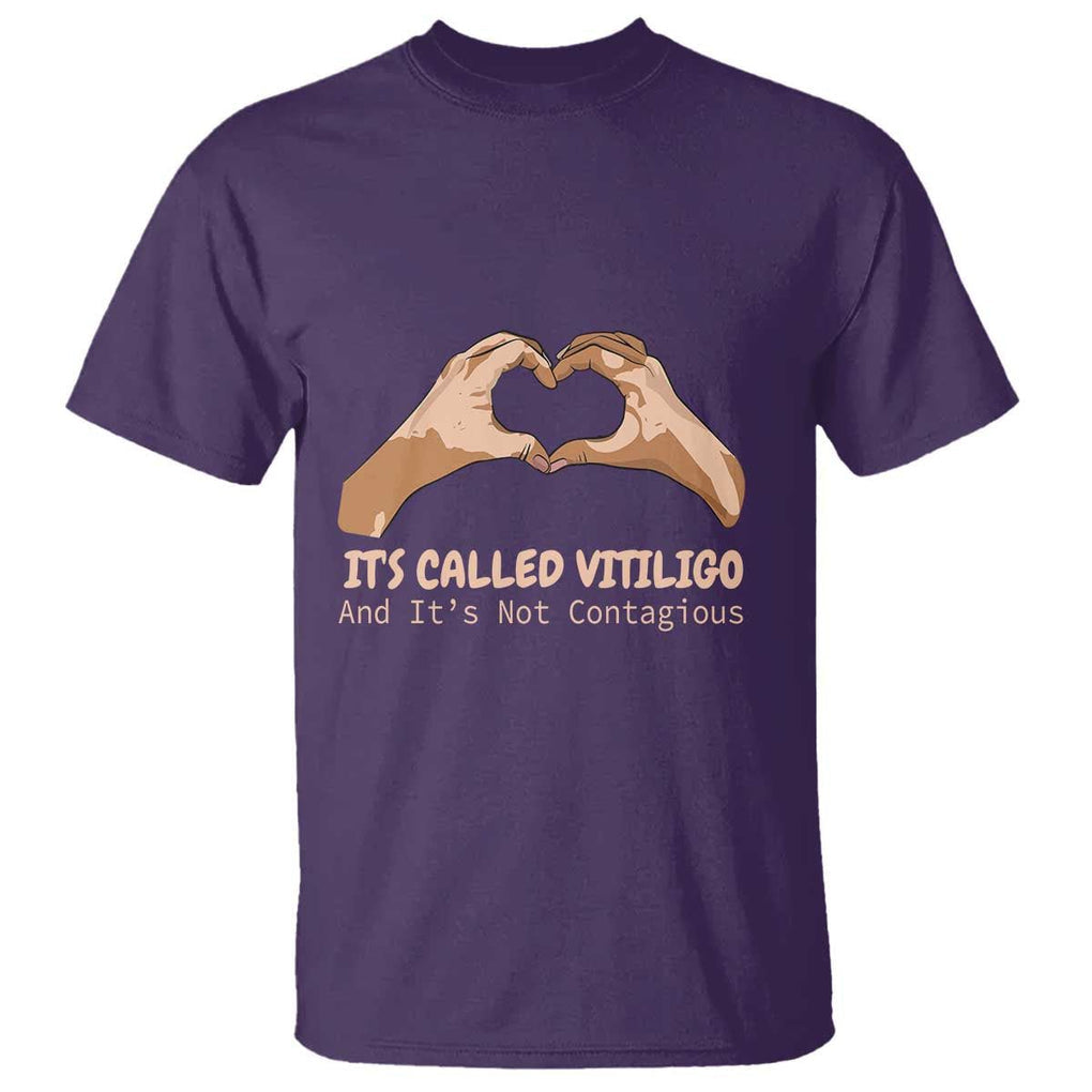 Vitiligo Awareness T Shirt It's Called Vitiligo And It's Not Contagious TS09 Purple Print Your Wear